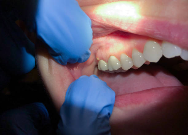 Best Orthodontic Emergency Dentist in Lookout Mountain, GA